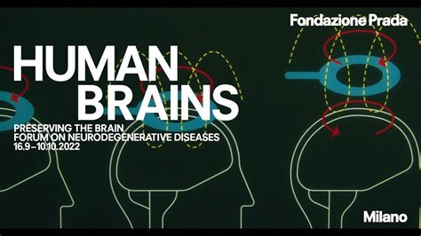 fondazione prada human brain|PRESERVING THE BRAIN – Fondazione Prada.